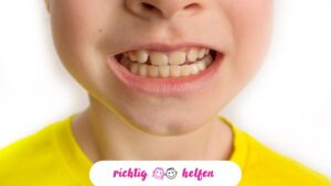 Kreidezähne bei Kindern erkennen