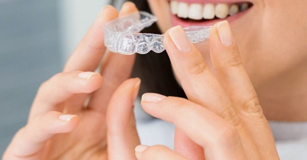 Aligner-Systeme: durchsichtige Schienen für Jugendliche