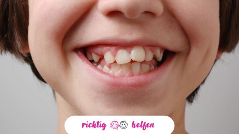 Kieferorthopädie bei Kindern: Welche Möglichkeiten gibt es heute?