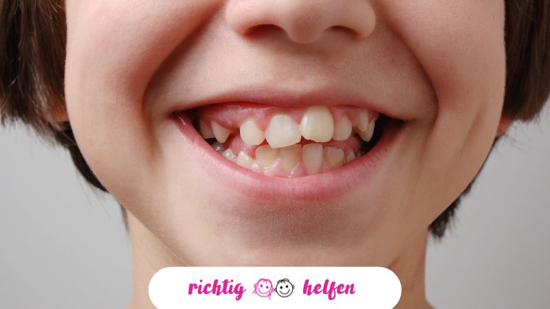 Kieferorthopädie bei Kindern: Welche Möglichkeiten gibt es heute?